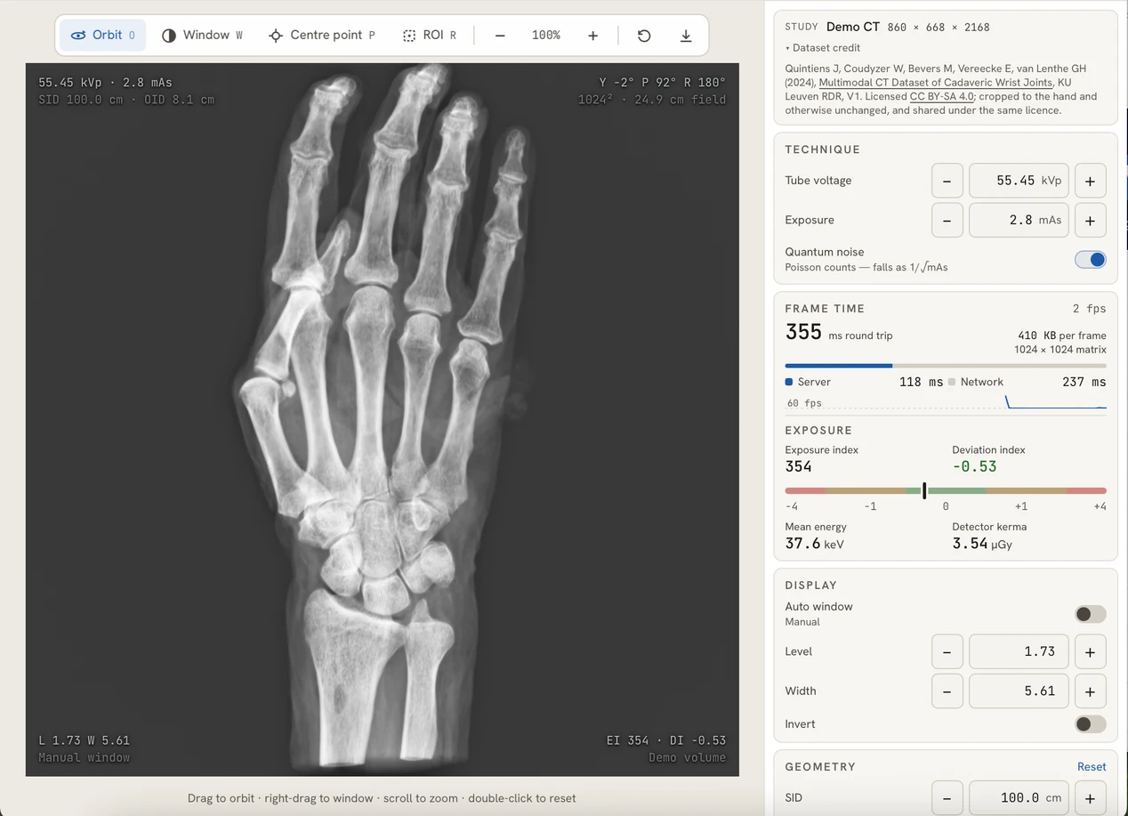 Hand radiograph and exposure controls in the projector